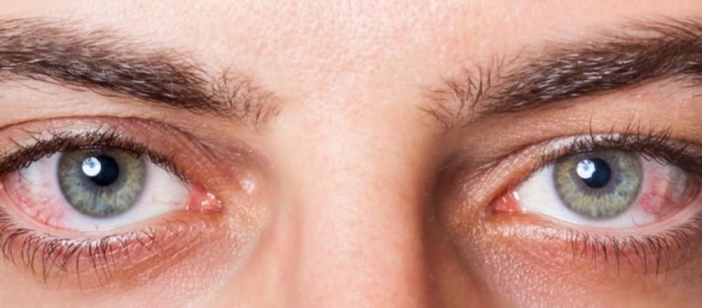 Πόσο επηρεάζει τα μάτια μας η ατμοσφαιρική ρύπανση;